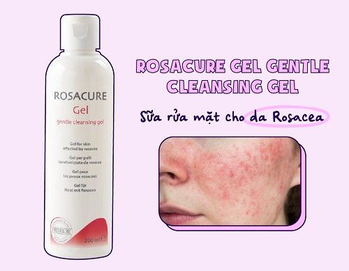 gel rửa mặt aknicare rosacure gel gentle cleansing gel