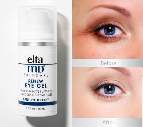 kết quả sau khi sử dụng gel dưỡng mắt eltamd renew eye gel 