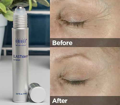 trước và sau khi dùng obagi elastiderm eye complete complex serum