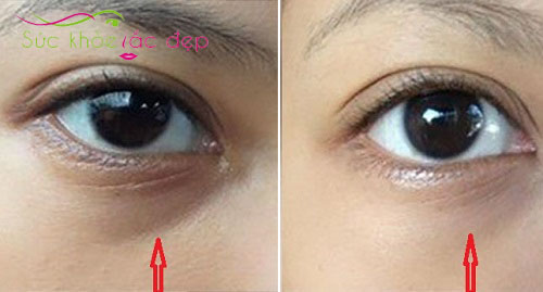 Review tốt về hiệu quả của Eye Care Lotion