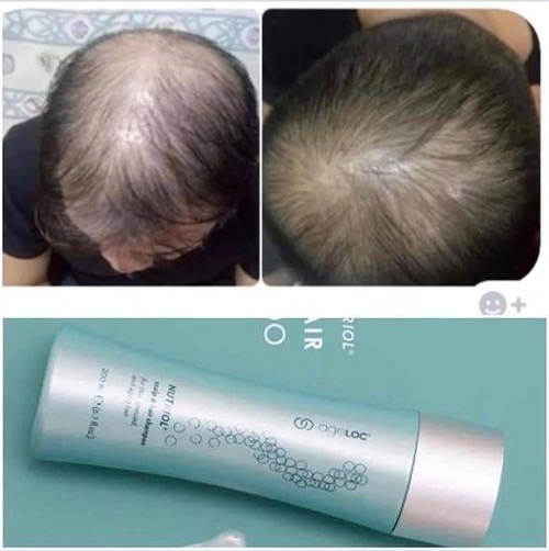ageloc nutriol scalp hair shampoo giúp làm sạch và giúp tóc dày hơn