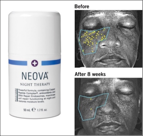 hiệu quả sau khi sử dụng neova night therapy dna repair copper peptide