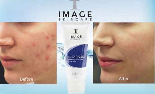 image clear cell mattifying moisturizer ngăn ngừa và hỗ trợ điều trị mụn trên da